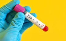 USA: premier cas connu de transmission sexuelle du Zika par une femme