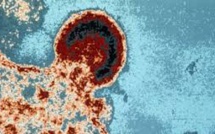 Il n'y aura pas rapidement de remède pour guérir du sida, préviennent les chercheurs