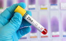 Canada: un vaccin anti-Zika testé pour la première fois sur l'homme