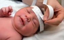 Zika: des "dizaines de milliers" de bébés pourraient naître avec des malformations ou d'autres affections